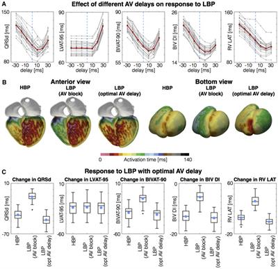 The role of conduction system pacing in patients with atrial fibrillation